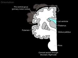 Bells Palsy and Stroke Instructional Video
