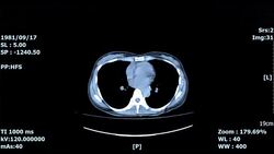 medical ct scan Stock Footage