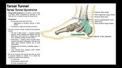 Tarsal Tunnel Syndrome | Clinical Anatomy & Presentation Instructional Video