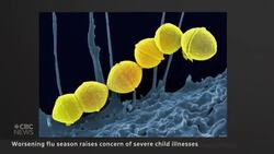 B.C. recorded 5 influenza deaths in kids under 18: coroners service News Clip