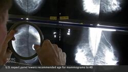Routine mammograms should start at 40, U.S. task force says News Clip