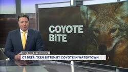 Authorities: Coyote attacks girl and her father in Watertown News Clip