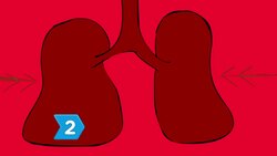 How to Recognize Mesothelioma Symptoms Instructional Video