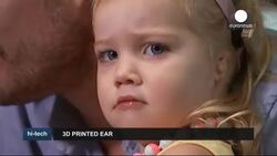 Girl to be fitted with 3D printed ear in Australia News Clip