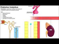 Diabetes Insipidus | Mechanism & Signs/Symptoms Instructional Video