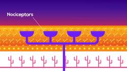 Can a person feel no pain? (Congenital insensitivity to pain: CIP) Instructional Video