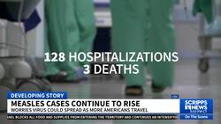 As summer travel increases, measles cases continue to rise News Clip