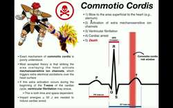 The Mechanism of Commotio Cordis Instructional Video