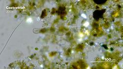 How Do Microorganisms Poop Without a Butthole? Instructional Video