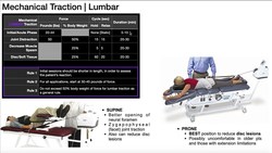 Mechanical Traction | Theory, Indications, Contraindications, & Parameters Instructional Video