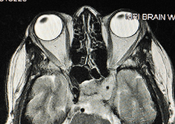 Cómo vemos. Segunda parte: el cerebro Instructional Video