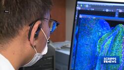 Study: Alzheimer's blood test diagnosed 91% of dementia cases News Clip