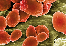 What lives on our skin? Instructional Video