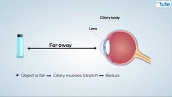 Understanding Myopia and Hyperopia: A Guide to Short and Long Sightedness Instructional Video