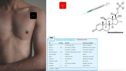 Iontophoresis EXPLAINED Theory, Use, & Example with Calculations Instructional Video