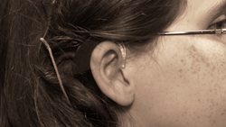 New implant may provide clearer, richer sound for people who are deaf Instructional Video