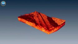 New technology gives an unprecedented look inside capillaries! Instructional Video