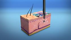 Tattoo needles leave behind metal particles that spread to lymph nodes, study finds Instructional Video