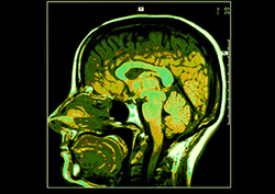 MRI Instructional Video