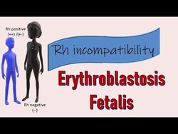 Rh Incompatibility Instructional Video