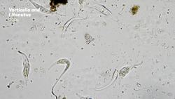 Are Microbes Good or Bad for Humans Instructional Video