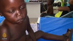 DR Congo faces deadliest meningitis outbreak on record News Clip