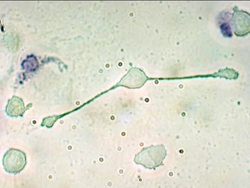 The Human Immune System and the Lymphatic System Instructional Video