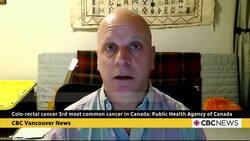 Colorectal cancer 3rd most common cancer in Canada: Public Health Agency of Canada News Clip