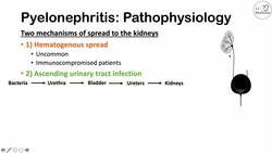 Pyelonephritis (Kidney Infection) | Causes, Pathophysiology, Signs & Symptoms, Diagnosis, Treatment Instructional Video