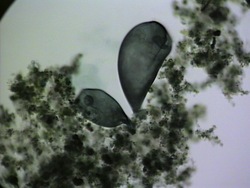 Células: resumiendo Instructional Video