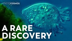 This Extremely Rare Ciliate Has Only Been Seen Four Times Instructional Video