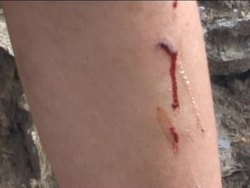 The Microscope: Introduction Instructional Video