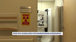 FDA mandate requires women to be informed about their breast density Instructional Video