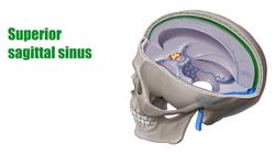 Superior sagittal sinus Instructional Video
