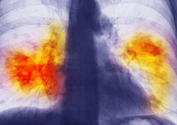 What is Cancer? Instructional Video