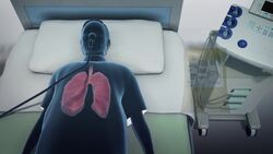 Plasma from recovered patients may help treat COVID-19 Instructional Video