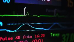 Vital signs monitor Stock Footage