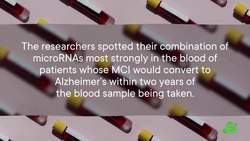 Could We Spot Alzheimer’s Early With RNA? | SciShow News Instructional Video