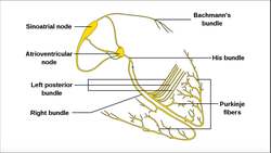 EKG Patterns Supraventricular Tachycardia Instructional Video