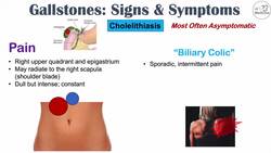 Gallstones Signs & Symptoms, Why They Occur | Cholecystitis, Choledocholithiasis, Cholangitis Instructional Video
