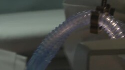 VOICED : ADN heredado del Neandertal puede provocar manifestaciones más graves de covid-19 News Clip