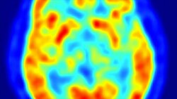 The Brain and Motor Control: Understanding How We Move Instructional Video