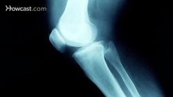 How to Assess Joint Pain Instructional Video