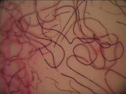 Introduction to Classifying Monerans and Protists Instructional Video