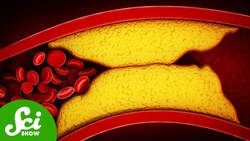 There's a Third Kind of Cholesterol (It's Really Bad) Instructional Video