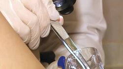 Closeup of female doctor gynecologist in blue gloves holding plastic gynecological mirror in gynecological room at medical center. Unrecognizable female doctor gynecologist working with patient. Vaginal Smear. Stock Footage