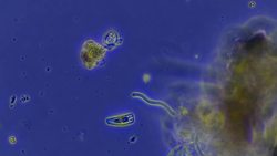 Life Without Oxygen Challenge Accepted Instructional Video