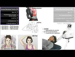 Mechanical Traction | Clinical Prediction Rules [CPRs] EXPLAINED Instructional Video
