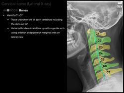 Anatomy of a Cervical x-ray Instructional Video