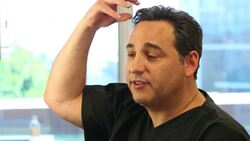 How to Use Tattooing to Hide Hair Loss Instructional Video